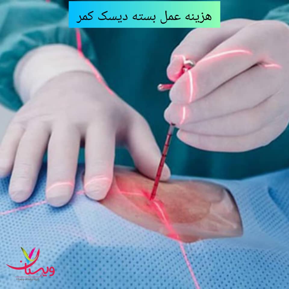 هزینه عمل دیسک کمر بسته هزینه عمل دیسک کمر بسته
