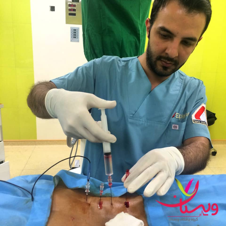 عمل دیسک کمر بسته عمل دیسک کمر بسته