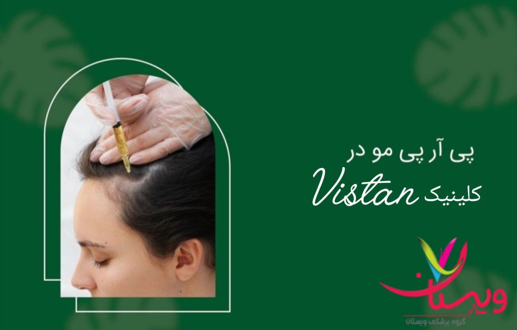 بهترین کلینیک پی ار پی مو در تهران