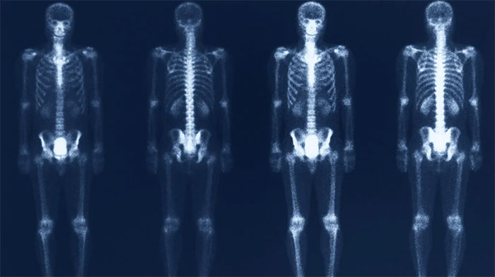 هزینه اسکن هسته ای استخوان نی نی سایت هزینه اسکن هسته ای استخوان نی نی سایت