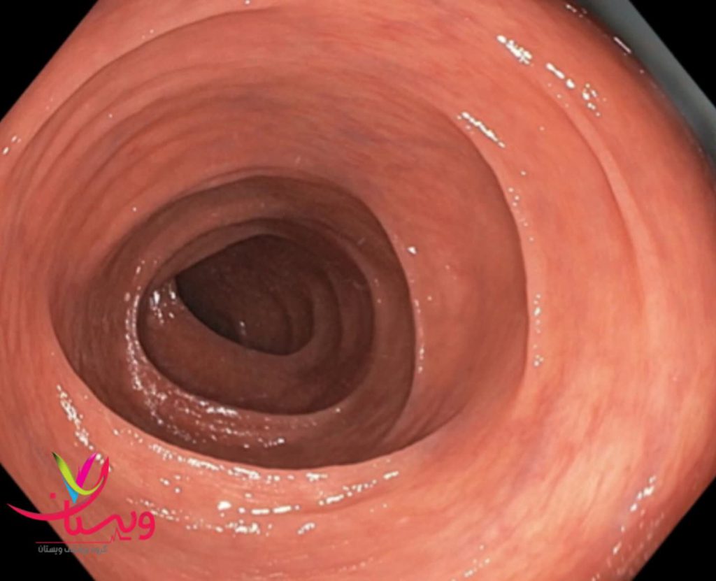 عکس colposcopy عکس colposcopy