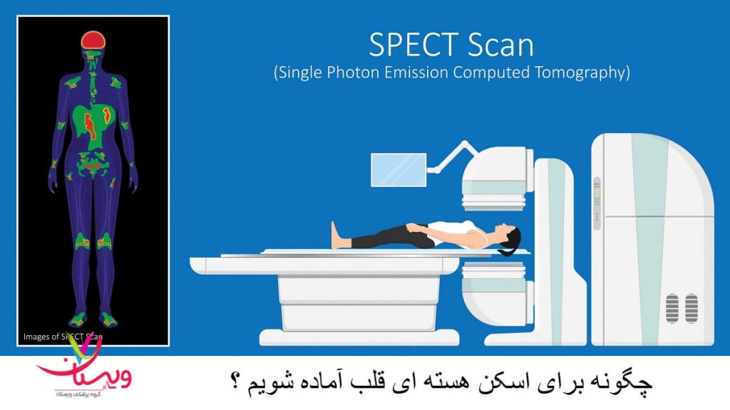اسکن قلب برای تشخیص بیماری های قلب کاربرد دارد اسکن قلب برای تشخیص بیماری های قلب کاربرد دارد
