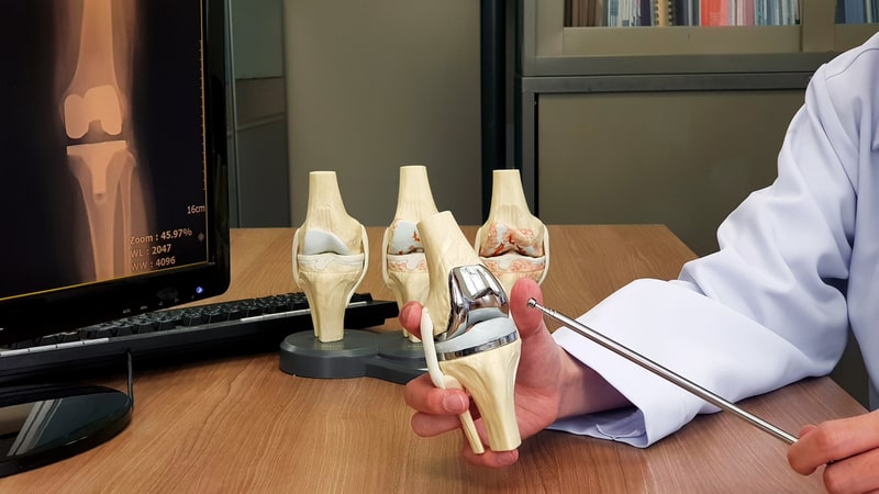 هزینه عمل تعویض مفصل زانو نی نی سایت هزینه عمل تعویض مفصل زانو نی نی سایت