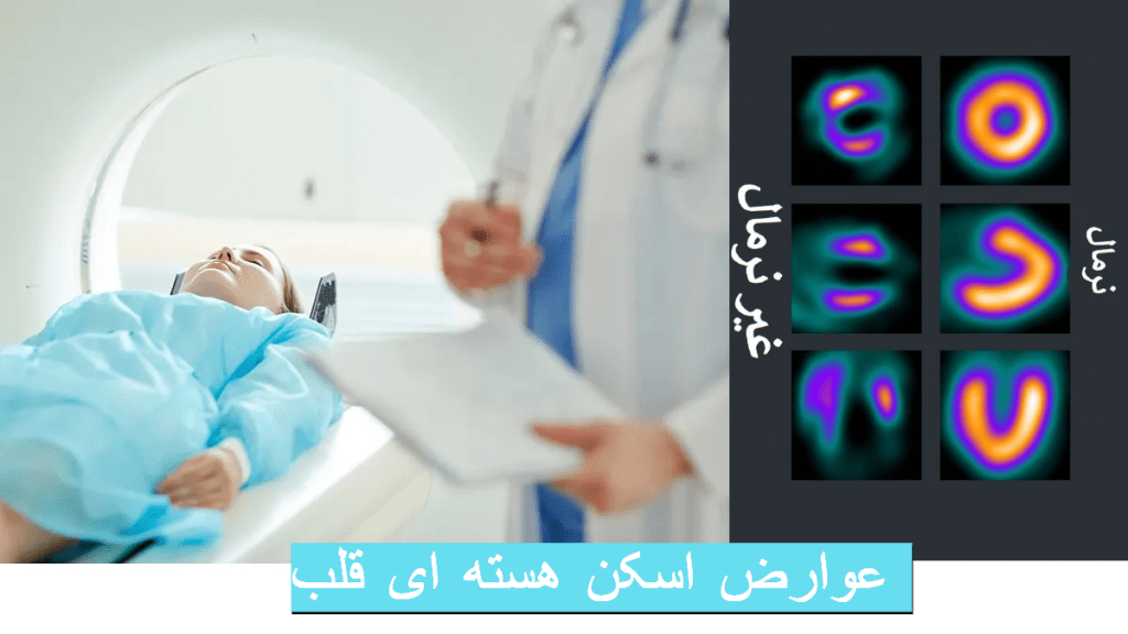 عوارض اسکن هسته ای قلب و تصویر نرمال و غیرنرمال آن