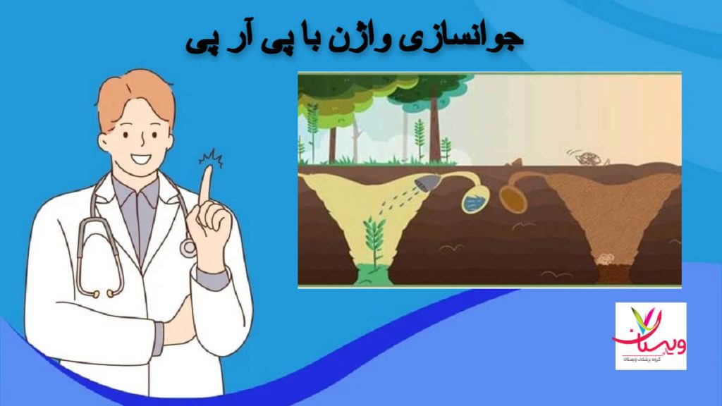 پی آر پی چیست ؟