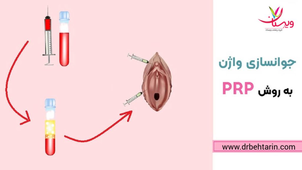 آیا پی آر پی واژن درد دارد؟