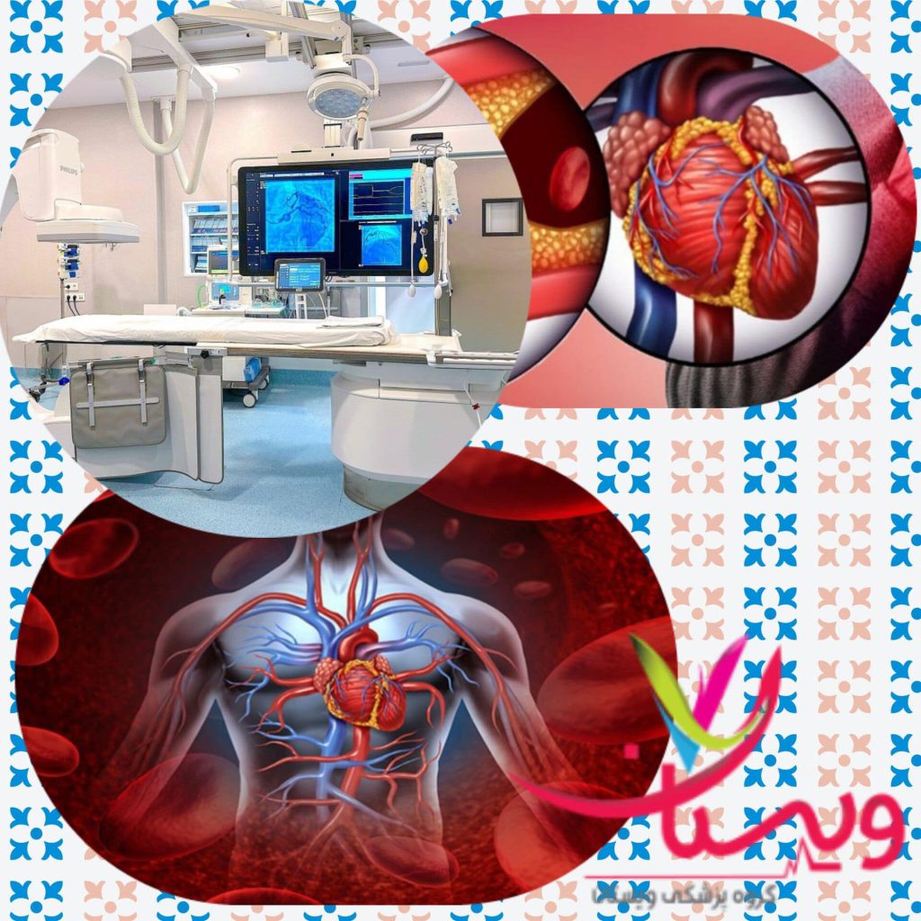 بهترین دکتر آنژیوگرافی قلب در تهران +10 فوق تخصص آنژیوگرافی