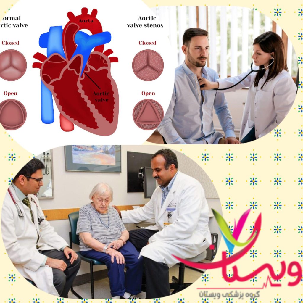 بهترین متخصص دریچه قلب درسال 1404+متخصص دریچه آئورت در تهران