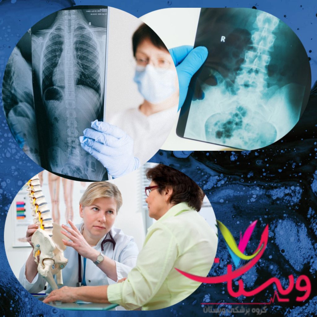بهترین دکتر دیسک کمر تهران 1404+متخصص دیسک کمر در غرب تهران