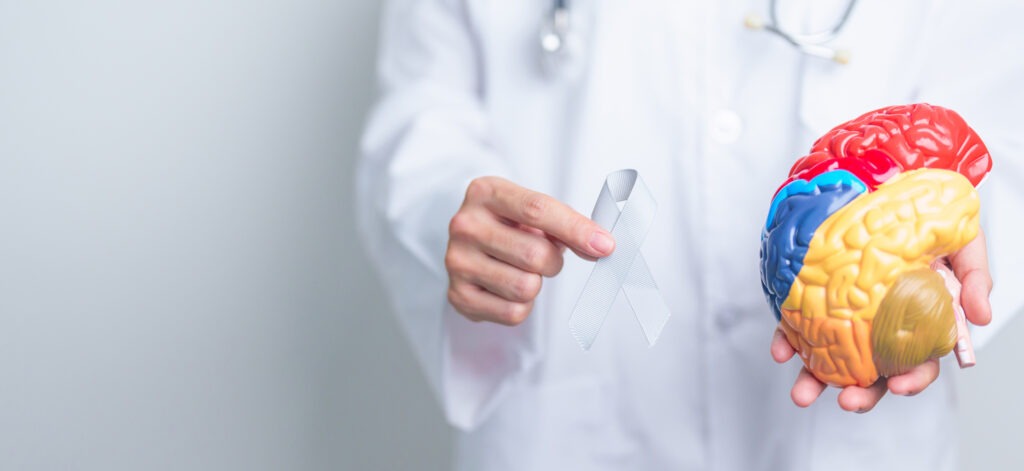 دکتر خوب برای سکته مغزی نی نی سایت دکتر خوب برای سکته مغزی نی نی سایت