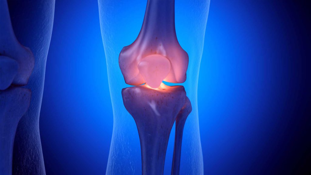 قیمت ژل تزریقی زانو قیمت ژل تزریقی زانو