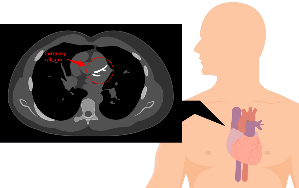 لیست مراکز سی تی اسکن قلب کرج لیست مراکز سی تی اسکن قلب کرج