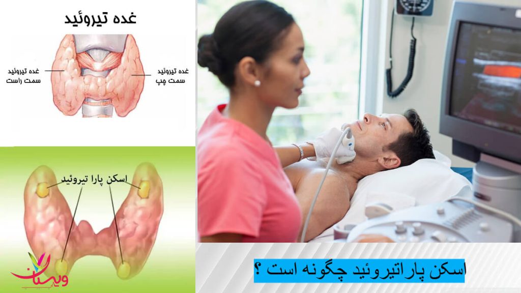 اسکن پاراتیروئید چگونه است؟/هزینه اسکن پاراتیروئید با بیمه