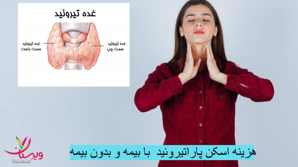 هزینه اسکن پاراتیروئید با بیمه و بدون بیمه 