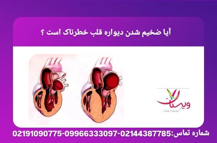 خطرات احتمالی ضخیم شدن عضله قلب  