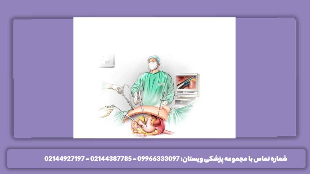 دکتر لاغری تهران لیست جراح معده در تهران و دکتر لاغری