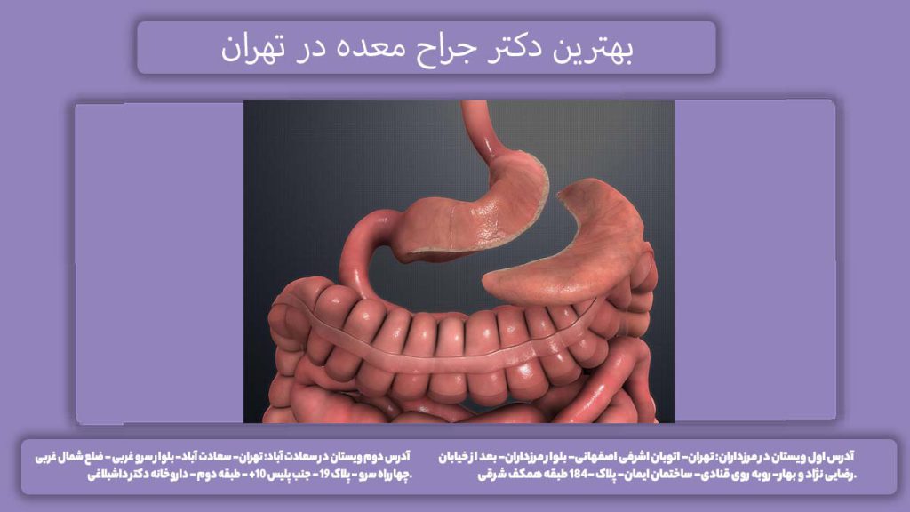 پزشک جراح خوب عمل معده بهترین دکتر جراح معده در تهران