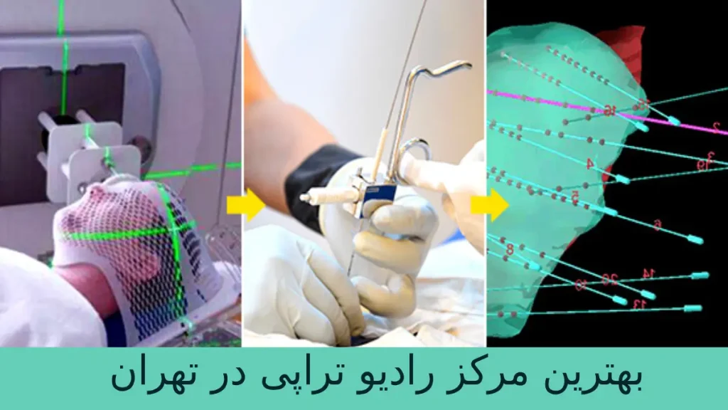 بهترین مرکز رادیوتراپی در تهران