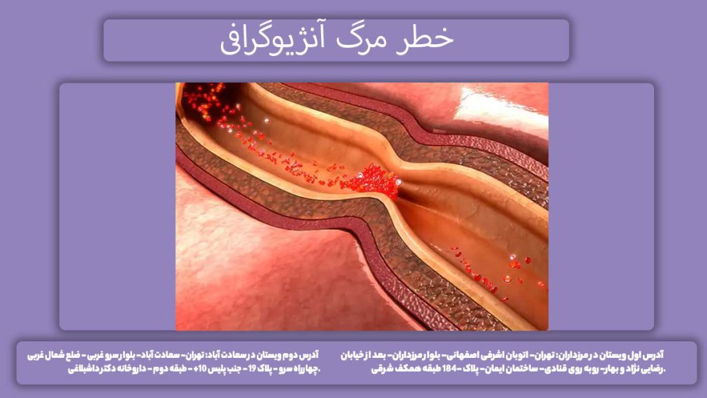 آیا آنژیو قلب خطر مرگ دارد