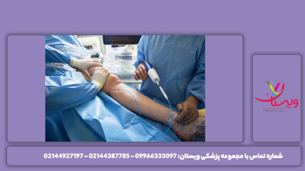 آیا آنژیو قلب خطرناک است و برای بدن ضرر دارد؟