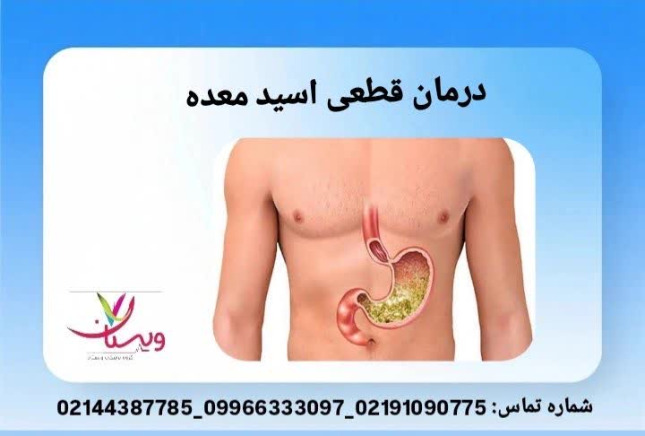 روشهای ترکیبی دارویی و اصلاح سبک زندگی برای درمان روش کامل درمان رفلاکس