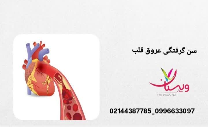 سن گرفتگی عروق قلب
