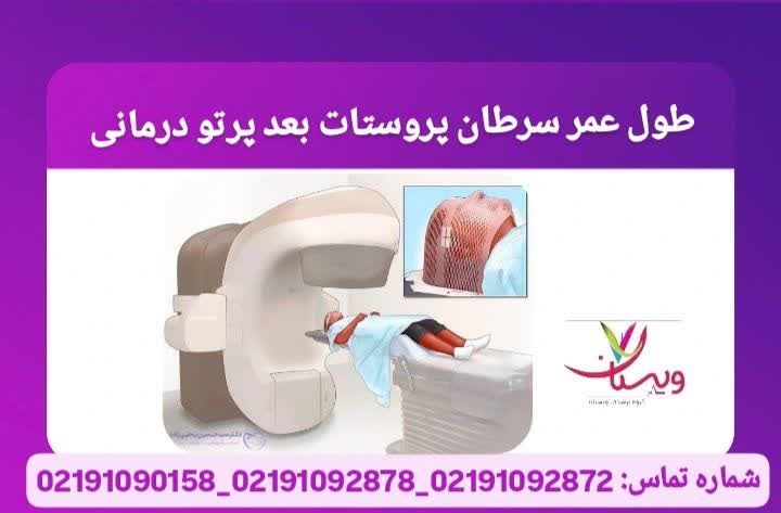 طول عمر سرطان پروستات بعد پرتو درمانی عوارض پرتو درمانی پروستات
