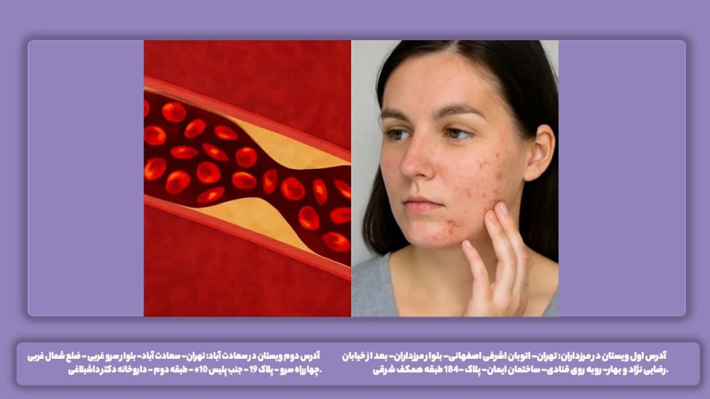 علائم ظاهری غلظت خون علائم غلظت خون بالا ( ظاهری)