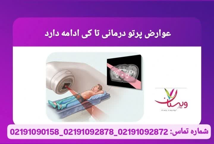 عوارض اولیه تا چند هفته، عوارض دیررس ممکن است ماهها طول بکشند. عوارض پرتو درمانی تا کی ادامه دارد