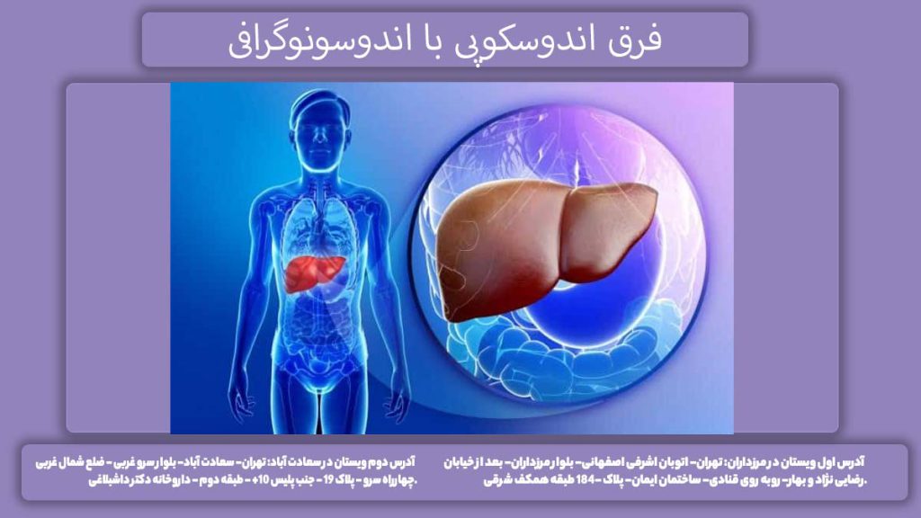 تفاوت اندوسکوپی با اندوسونوگرافی چیست؟ فرق اندوسکوپی با اندوسونوگرافی