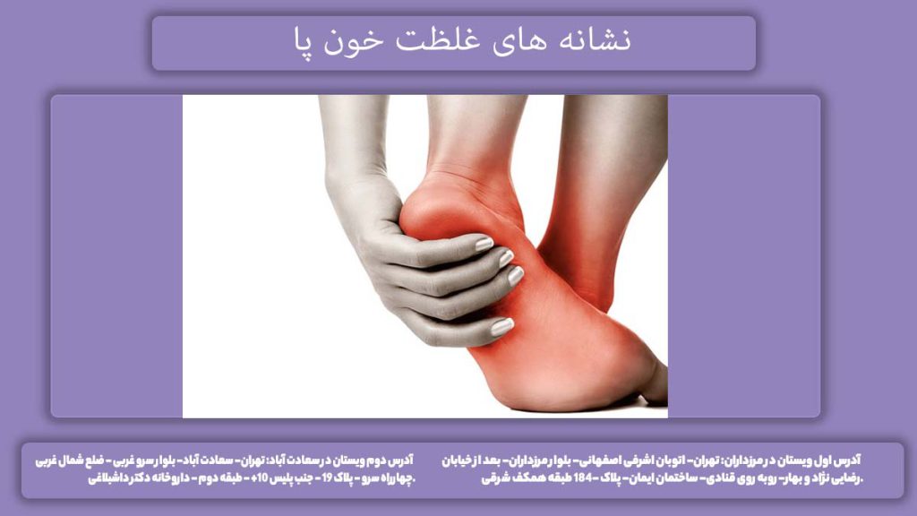 علائم غلظت خون در پاها