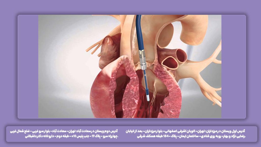 آیا روماتیسم قلبی درمان قطعی دارد