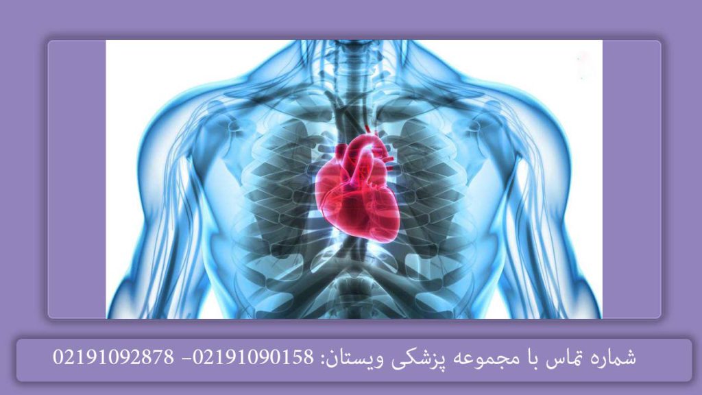 درمان روماتیسم قلبی​ در افراد بزرگسال