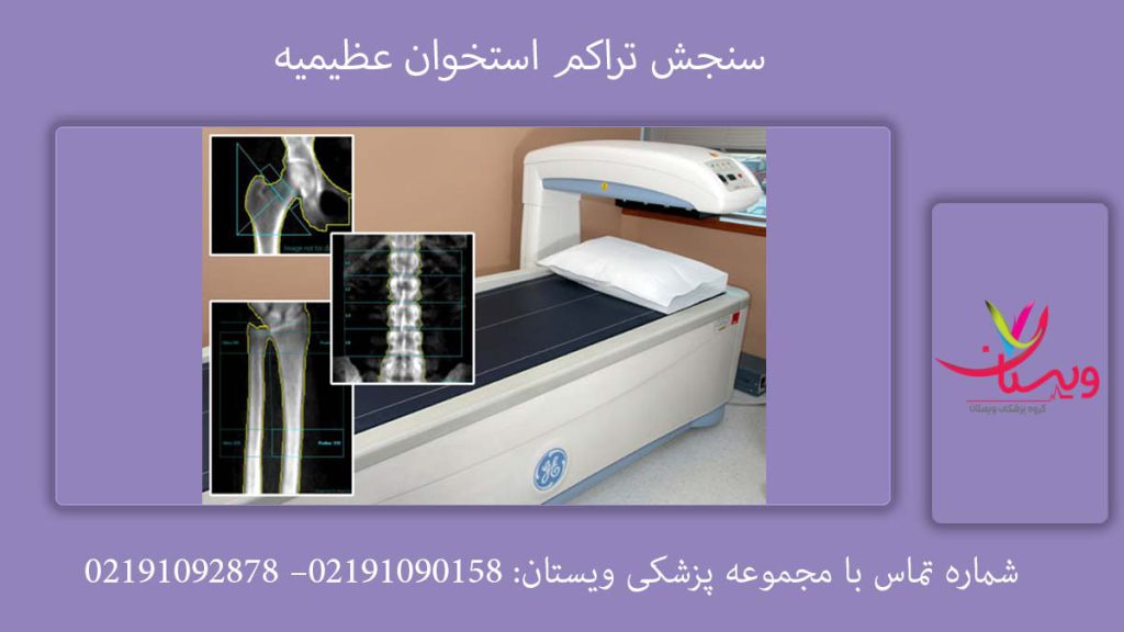 مراکز تراکم استخوان در کرج ( عظیمیه)