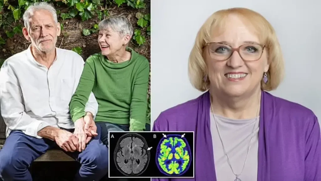 عوارض درمان آلزایمر با rTMS عوارض درمان آلزایمر با rTMS