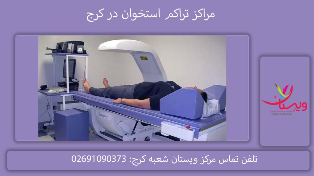 لیست مراکز تراکم استخوان در کرج