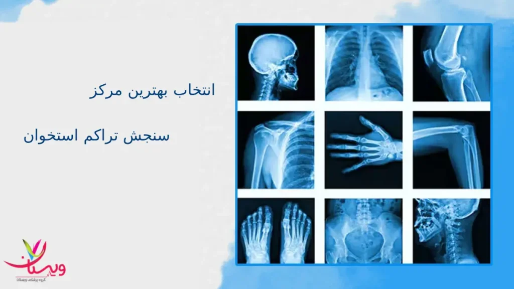 انتخاب بهترین مرکز سنجش تراکم استخوان انتخاب بهترین مرکز سنجش تراکم استخوان