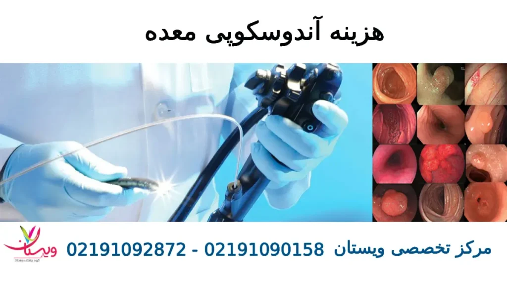 هزینه آندوسکوپی معده هزینه آندوسکوپی معده
