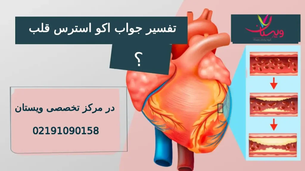تفسیر جواب اکو استرس قلب تفسیر جواب اکو استرس قلب