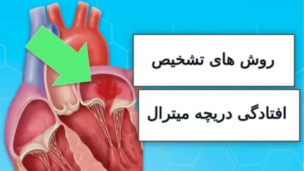 روش های تشخیص افتادگی دریچه میترال روش های تشخیص افتادگی دریچه میترال