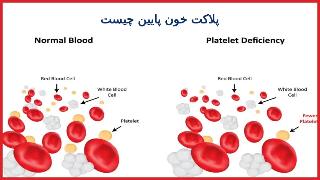 پلاکت خون پایین چیست
