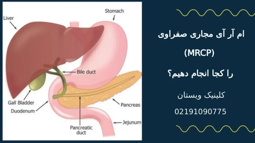 ام آر آی مجاری صفراوی (MRCP) را کجا انجام دهیم؟ کلینیک ویستان ام آر آی مجاری صفراوی (MRCP) را کجا انجام دهیم؟