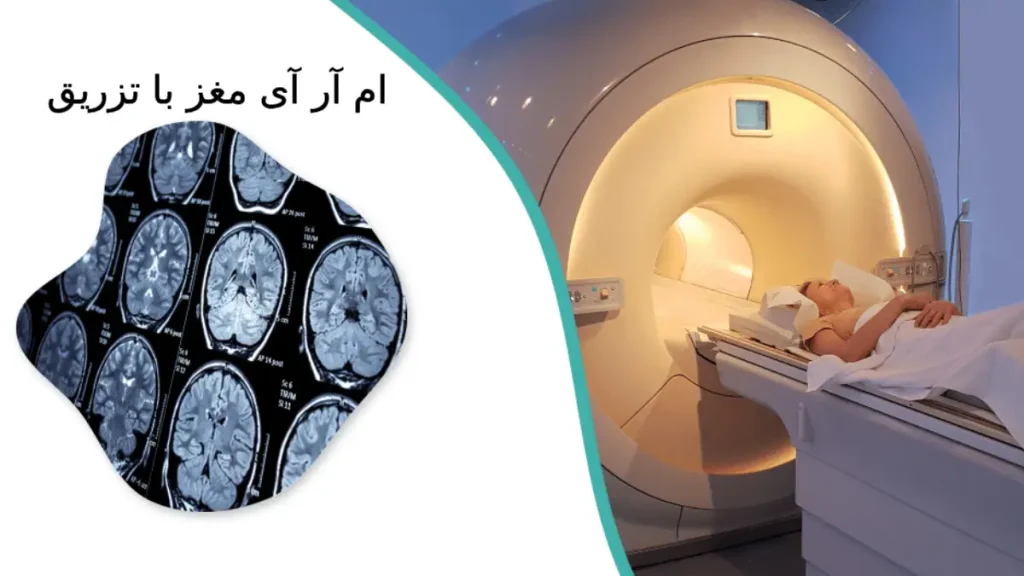 ام آر آی مغز با تزریق ویستان ام آر آی مغز با تزریق