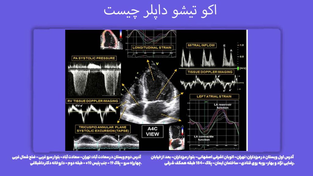 اکو تیشو داپلر اکو تیشو داپلر چیست