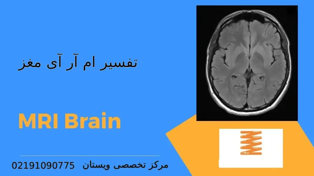 تفسیر ام آر آی مغز در مرکز ویستان تفسیر ام آر آی مغز