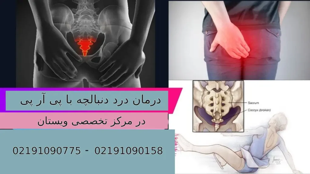 درمان درد دنبالچه با پی آر پی