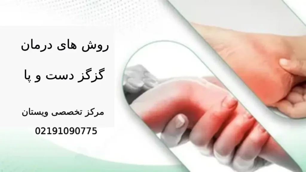 روش های درمان گزگز دست و پا روش های درمان گزگز دست و پا در مرکز تخصصی ویستان