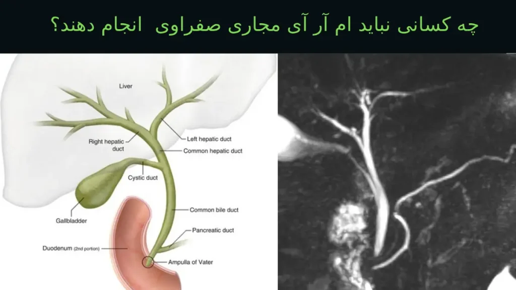 چه کسانی نباید MRCP)انجام دهند؟ چه کسانی نباید ام آر آی مجاری صفراوی (MRCP) انجام دهند؟