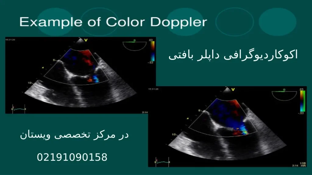 بهترین مرکز اکو داپلر قلب بهترین مرکز اکو تخصصی قلب
