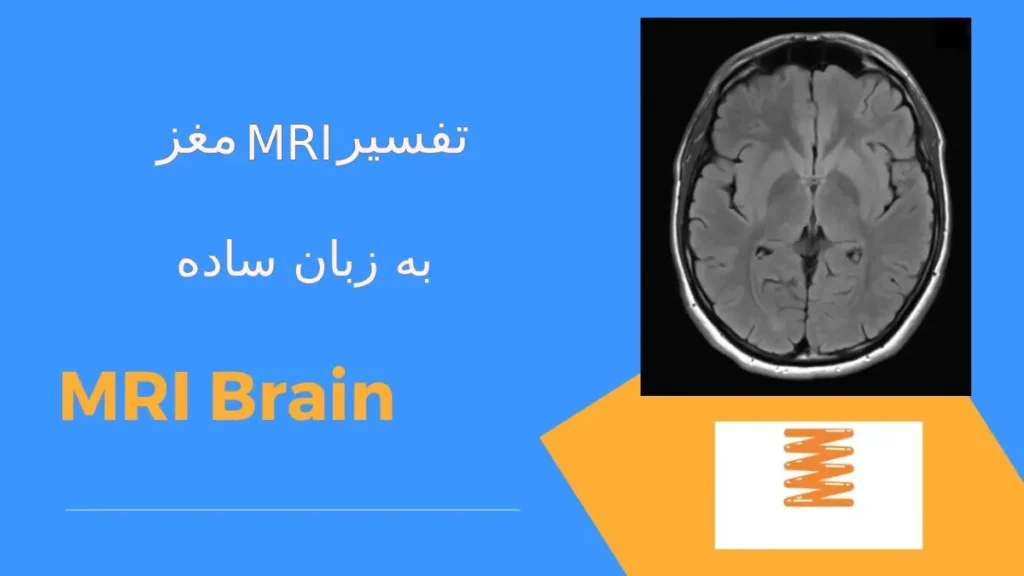 تفسیر ام آر آی مغز در کلینیک ویستان تفسیر ام آر آی مغز